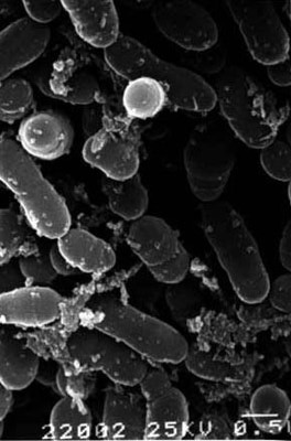 To Prevent Cavities, Swish With These Bacteria